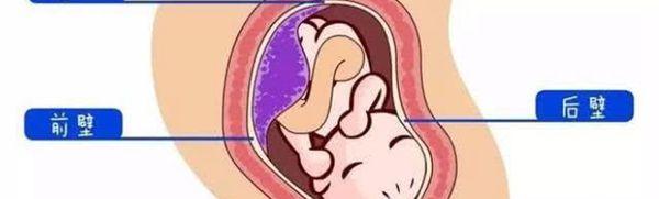 为何胎盘前壁怀孕后期下坠感强烈还累？