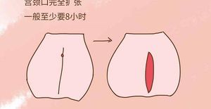 孕期剧烈运动可引起宫颈口扩张,预防从日常生活做起
