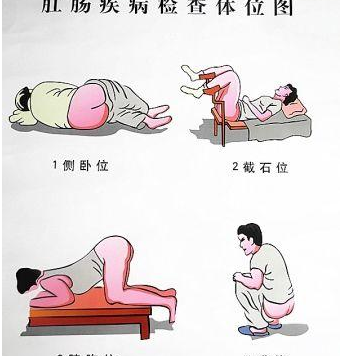孕妇和产妇都能做，胸膝卧位的这些适用人群可了解下