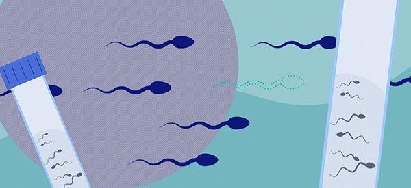 精子优化处理的时候能分离出XY精子吗?