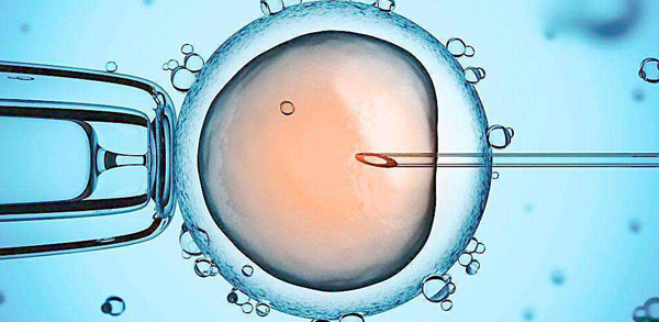 人工授精对精子要求并没那么严格,满足这3点就能手术