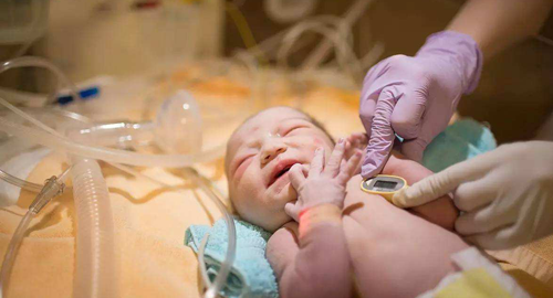 4个月新生儿巨细胞病毒感染,引起原因居然是她