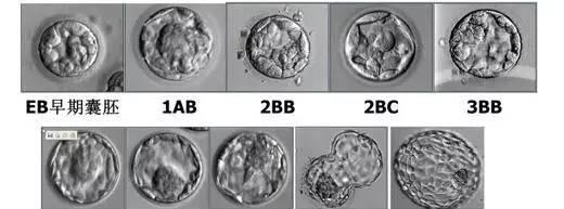 囊胚等级为4cb的孩子出生后会更聪明吗？