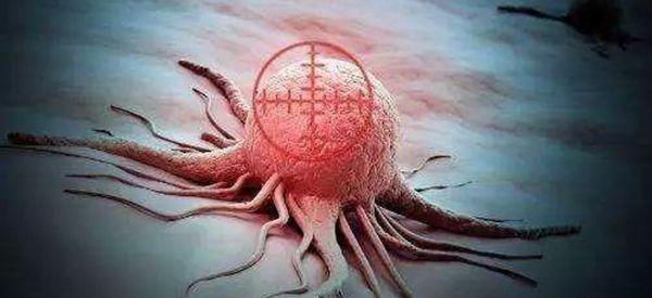 nk和nkt细胞免疫治疗肿瘤哪种更好？