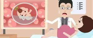 孕期检查的nt项的正常范围数值是多少？