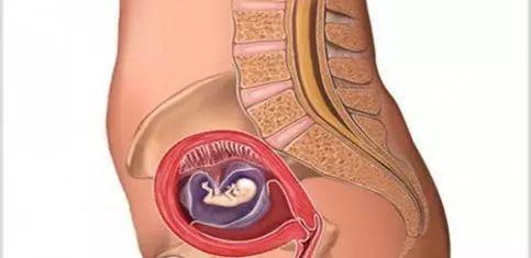 若试管婴儿胚胎移植后着床有这5种感觉，恭喜你怀孕了！