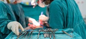 国家卫生系统为什么限制剖腹产？