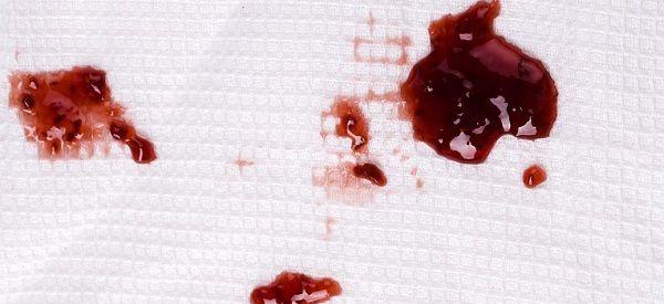 餐巾纸上风干的血可以做亲子鉴定吗？