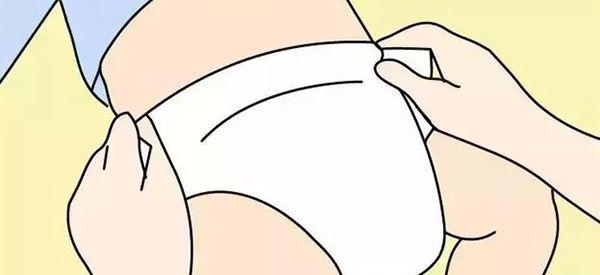 新生儿穿纸尿裤遮住肚脐的危害有哪些？