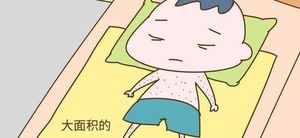 出现湿疹是氨基酸奶粉转奶不成功的表现吗？