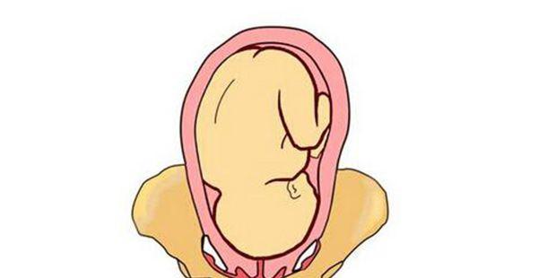 孕晚期横位转头位最快的方法有哪些？