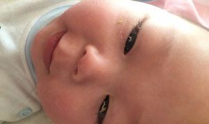 新生儿眼屎多又黄又粘稠，处理不当危害大！
