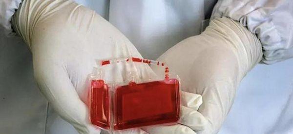 35周岁产妇捐赠脐带血有风险吗？