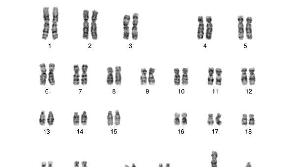 xy染色体异常闹剧：浅谈超雄、超雌对宝宝的影响