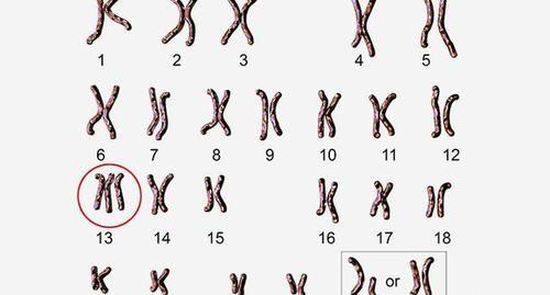 胎儿两次都有染色体13三体时下次再怀孕要注意什么？