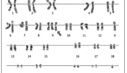 造成9号染色体三体的原因是什么？