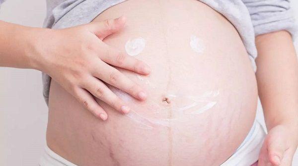 彻底祛除妊娠纹有2种方法可选择，药物治疗和激光手术