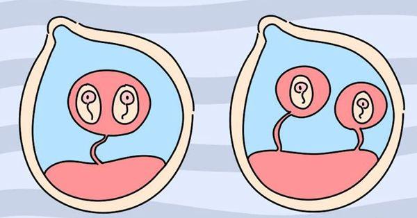 试管满足什么条件最适合放双胎妊娠？