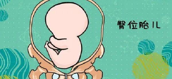 临盆前一个月胎儿头位和臀位自己能感觉出来吗？