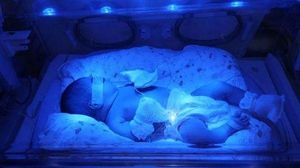 3分钟get溶血儿治疗指南：分产前和新生儿护理两个阶段