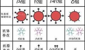 新生儿ABO、Rh型溶血症知多少：其形成原因各不相同