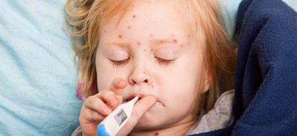 13个月小宝宝出疹子的症状有哪些？