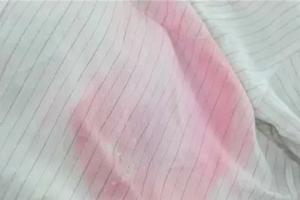 衣服染上水果汁去除小窍门，再顽固的污渍也怕这些大招