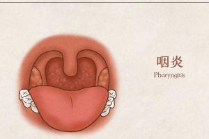 咽炎吃什么水果好？这7种水果治疗效果最佳