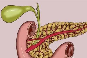 胰腺炎忌口一览表，这些食物再馋也不能碰