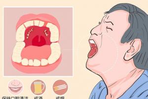 口腔癌早期的6个特征，希望你别错过抓癌时机