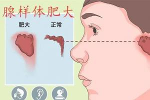 小孩腺样体肥大是怎么引起的？常见诱发因素有这四个