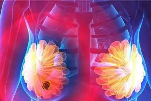 乳腺结节吃什么食物好？常吃七物有助于缓解病情