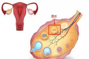 怎么判断自己是不是黄体破裂？看完你心中就有数了