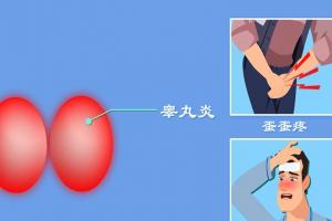 左侧睾丸疼痛是什么原因？这6个原因千万可别小觑