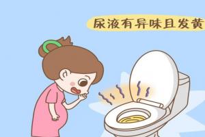 女性尿黄是什么原因？可能和这5个因素密切相关