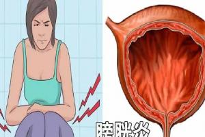 女性膀胱炎是怎么引起的？这三大诱因需及时了解