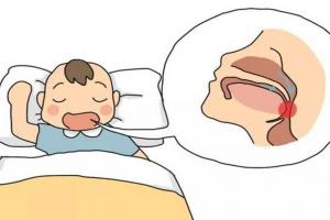 睡觉张嘴睡有什么危害？家长一定要及时解决