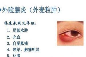 霰粒肿自愈的最佳方法，下面4种方法可以尝试