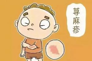 荨麻疹不能吃什么食物？这五类食物千万要远离