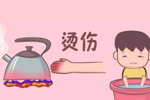 烫伤用什么方法好的最快？医生：要根据烫伤情况而定