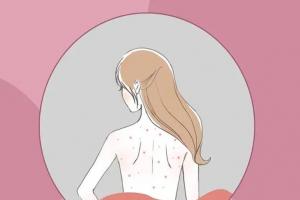 后背长痘痘是什么原因？看到这4个原因，就不足为奇了