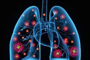 清肺养肺的最好方法，快给你的肺排排毒