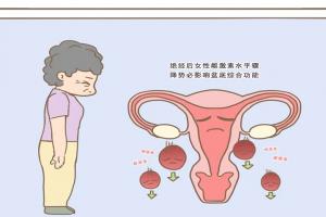 41岁绝经了可以做试管吗？满足3个条件才能保证成功率