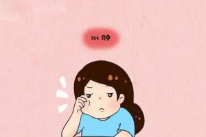 脸浮肿是什么原因引起？最后三个尤其要重视