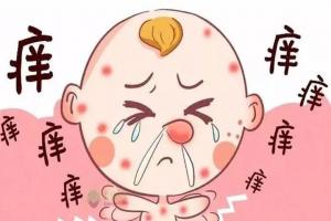 皮肤过敏最好的自愈方法，远离过敏原是重中之重