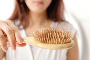 女性斑秃是身体哪里出毛病了？盘点女性斑秃的6大原因