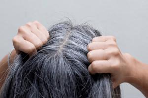 三个部位长白发最危险，分别是后脑勺、两鬓、前额