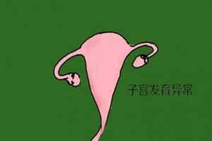 子宫畸形要怎么做试管？附2023子宫畸形试管攻略