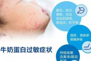 宝宝牛奶过敏有哪些症状？宝宝牛奶过敏要怎么办？