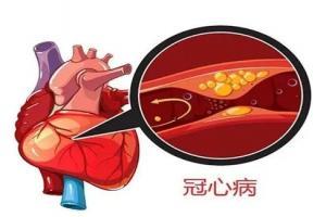 冠心病的症状表现在哪些方面?冠心病要如何调理改善?